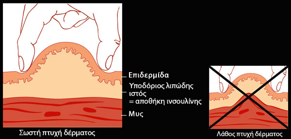 Correct Skinfold GR: Correct Skinfold GR (© Wellion)