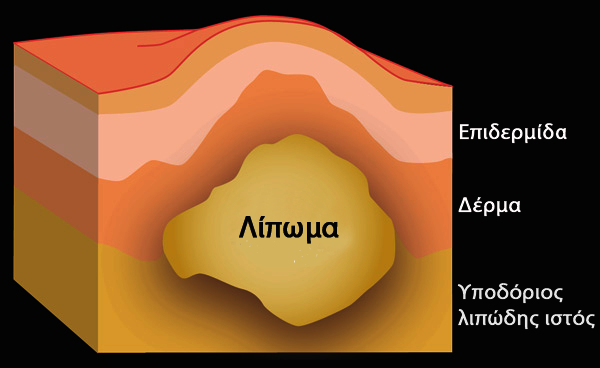 About Lipom GR: About Lipom GR (© Wellion)