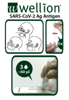 SARS-CoV-2 Ag Antigen übersicht:  (© )