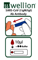 SARS-CoV-2 Ab übersicht:  (© )